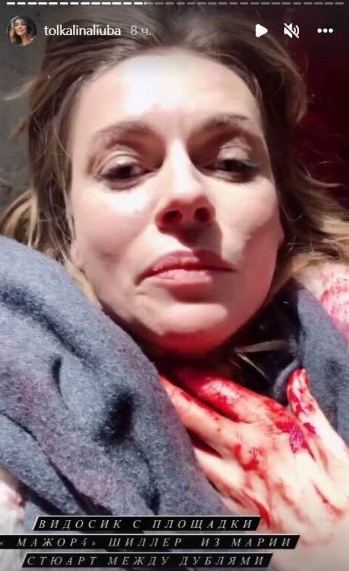 Бледная и держится за шею: в Сеть попало жуткое фото окровавленной Толкалиной