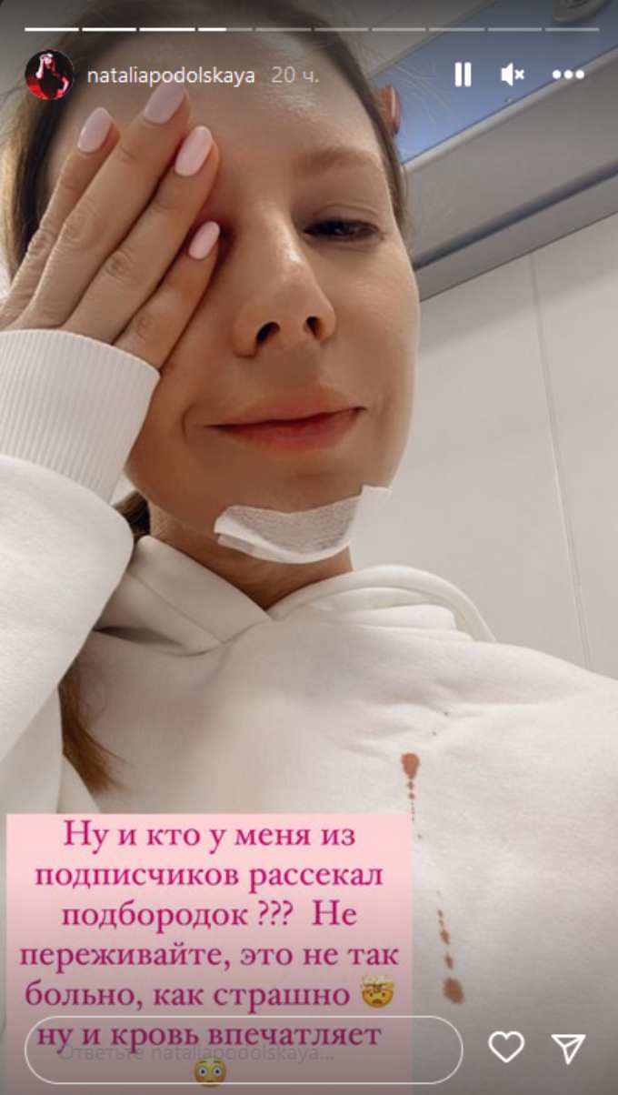 «Страшно»: Подольская вышла на связь в окровавленной одежде и рассеченным лицом