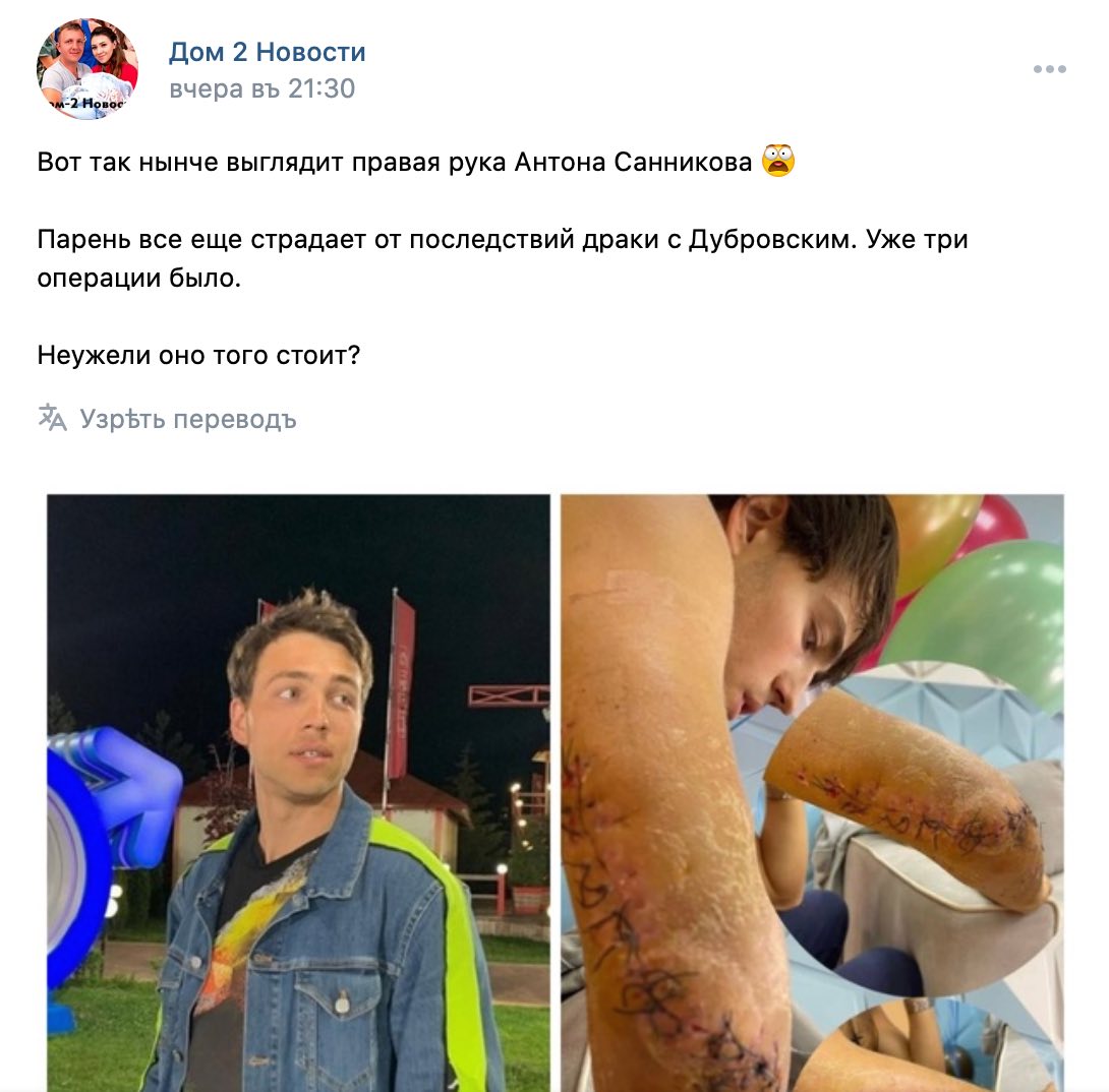 На «Доме-2» покалечили участника: фото гниющего заживо Антона Санникова