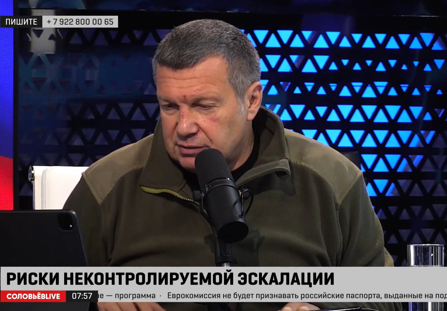 Жуткие синяки и царапины: Соловьев показал изувеченное лицо после угрозы Пугачевой «набить морду»