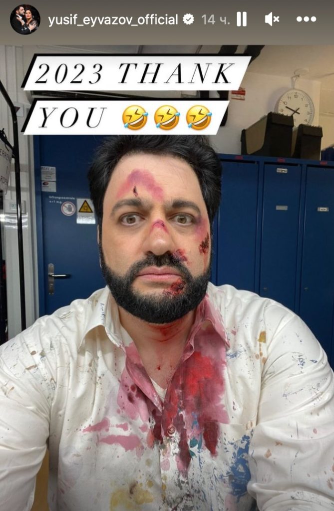 Весь в крови, нос перебит: мужа Нетребко в ужасном состоянии нашли в Швейцарии