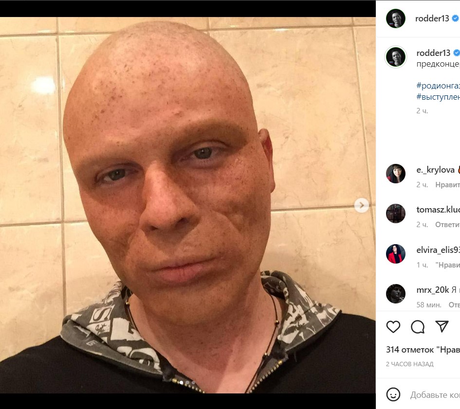 Без волос и бровей: неузнаваемый Газманов показал лицо