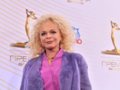 «В тягость»: Долина откровенно о бывшем муже, сцене и планах на будущее