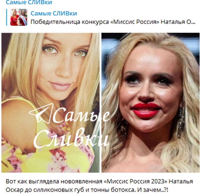 «Без силиконовых губ и немигающего взгляда»: как выглядела «Миссис Россия 2023» Наталья Оскар до роковых манипуляций