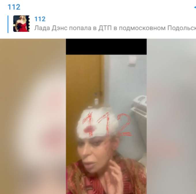 Появились фото Лады Дэнс из больницы: окровавленные бинты и неузнаваемое лицо