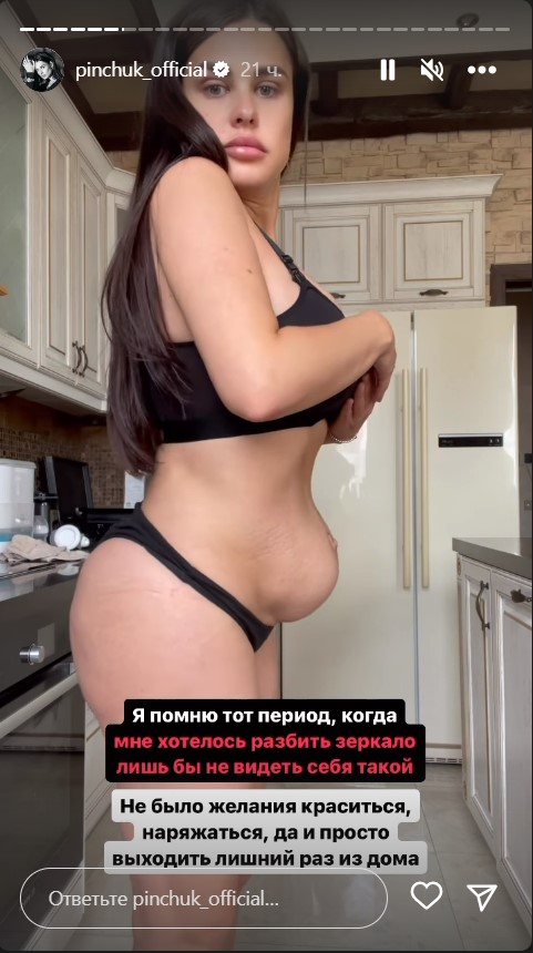 «Вывалились все внутренности»: видео обезображенной Пинчук из "Дома 2" попало в Сеть 