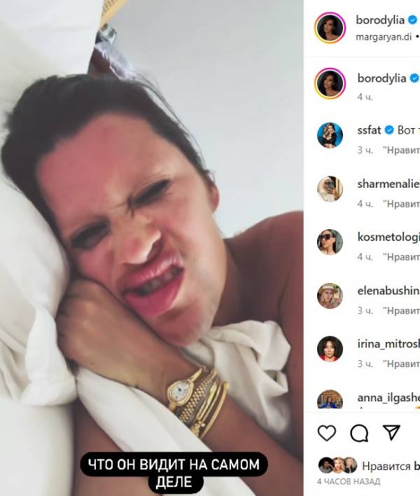 Уродливо надутые губы, увеличенный нос и щетина: что со своим лицом сделала Ксения Бородина