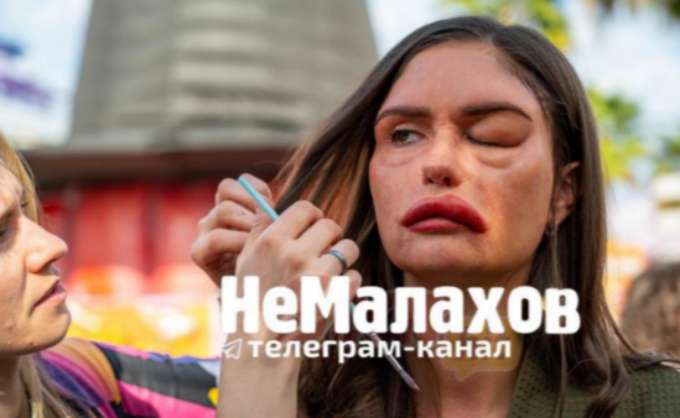 Получившую удар от Прилучного Муцениеце не узнать: на лице живого места не осталось