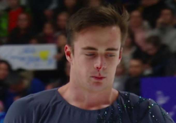 «Размазывала при всех, пока у него кровь хлестала»: Косторная устроила истерику после неудачного проката с мужем