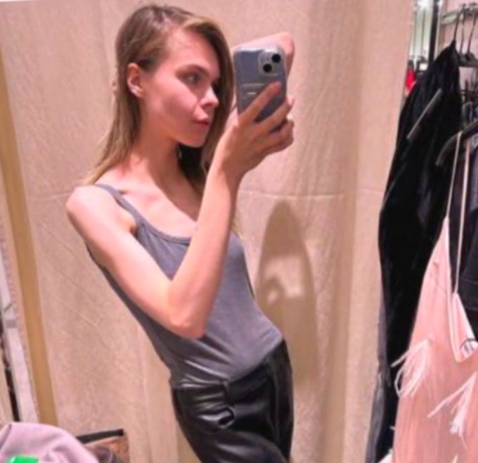 Дорогостоящая клиника, инвалидное кресло и капельницы: страдающая от тяжелой болезни дочь Астахова впервые рассказала о своем состоянии