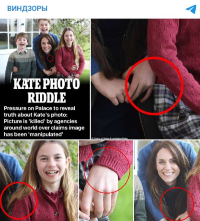 Фото Кейт Миддлтон после операции оказалось фейком: что скрывает дворец?