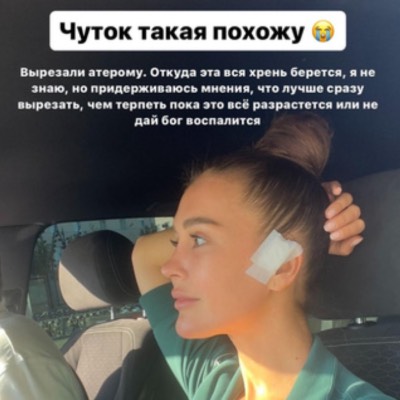 Вырезали опухоль: перебинтованная Бузова вышла на связь после операции