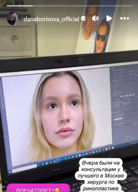 «Здорово – совсем другое лицо!» Дана Борисова отвела единственную дочь к пластическому хирургу
