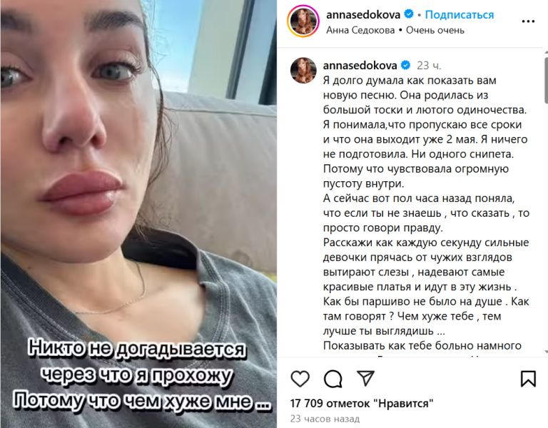 «А вы знаете, каким он стал?» Седокова цинично атаковала покойного Тимму