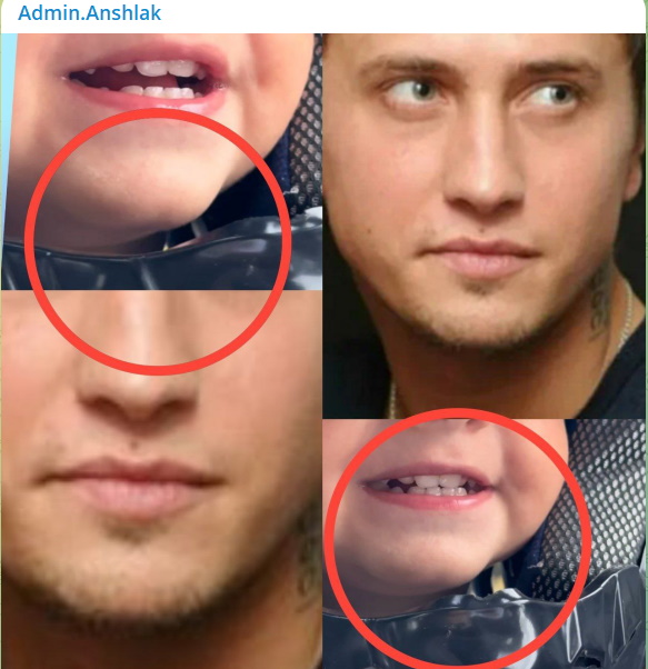 Эту особенность «передает своему ребенку папа»: почему Прилучного гонят на ДНК-тест3333