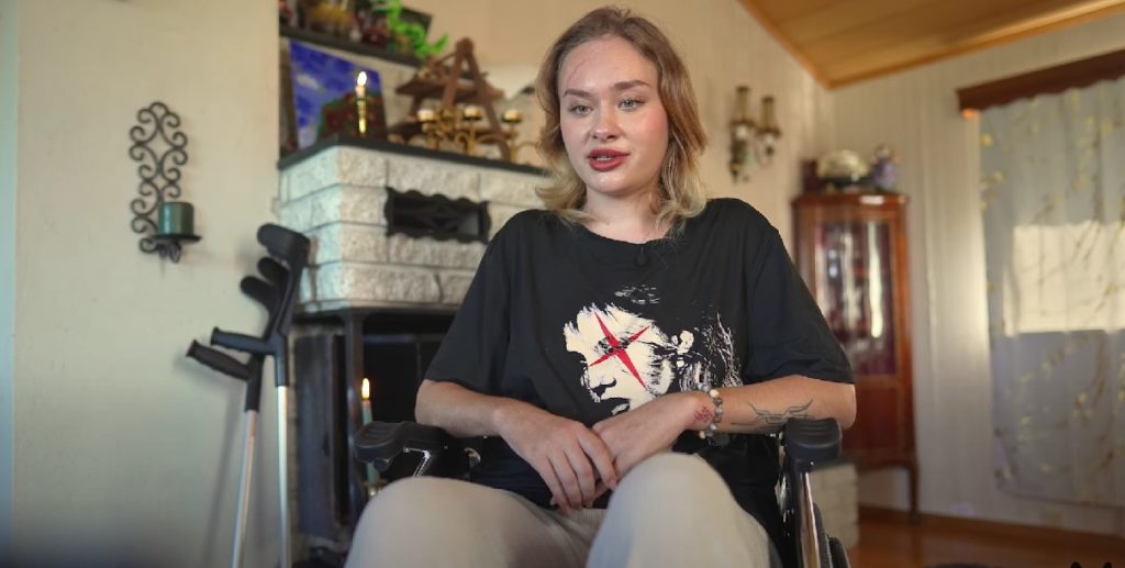 Инвалидное кресло и огромный шрам на лице: избитая в Дубае Мария Ковальчук рассказала, что на самом деле с ней произошло