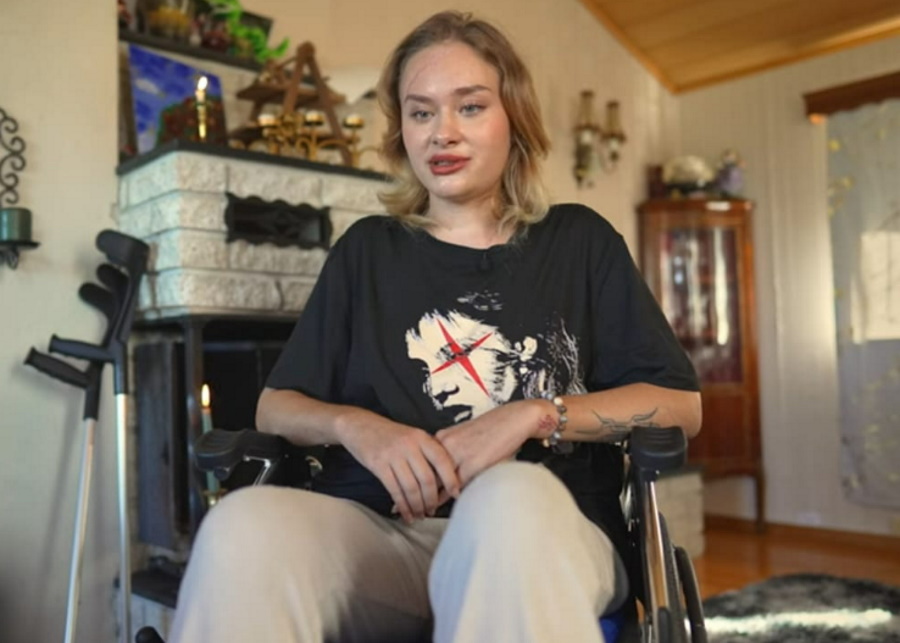 Инвалидное кресло и огромный шрам на лице: избитая в Дубае Мария Ковальчук рассказала, что на самом деле с ней произошло