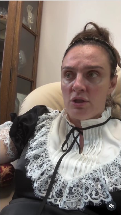 «Меня уже тошнит на саму себя смотреть»: Елена Ваенга находится под капельницей из-за болезни