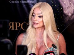 «Алопеция?»: Волочкова отчаянно скрывает плешь