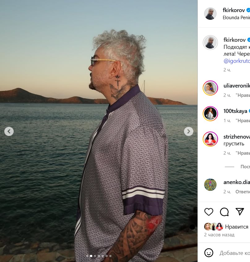 Филипп Киркоров показал незаживающие из-за диабета ожоги: «Вместе с кожей стащили костюм»