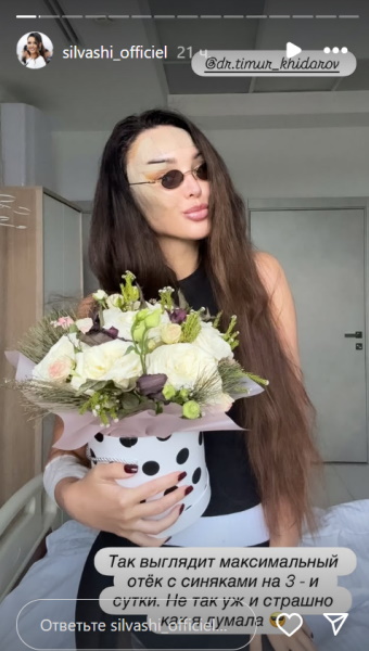 Уговоривший жену на пластику Хайдаров: «После родов лицо у девушек теряет молодость!» 