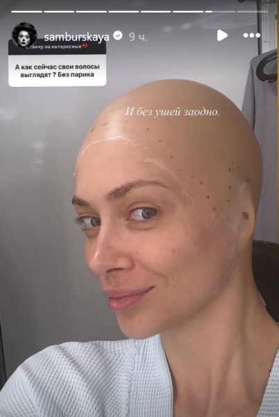 «Хоть бы волосок оставила!»: вот как Настасья Самбурская выглядит без парика 