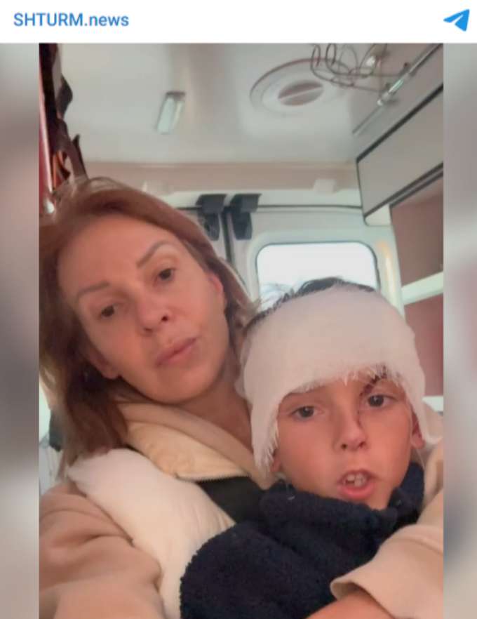 Внуку Натальи Штурм пробили голову булыжником: подробности и фото