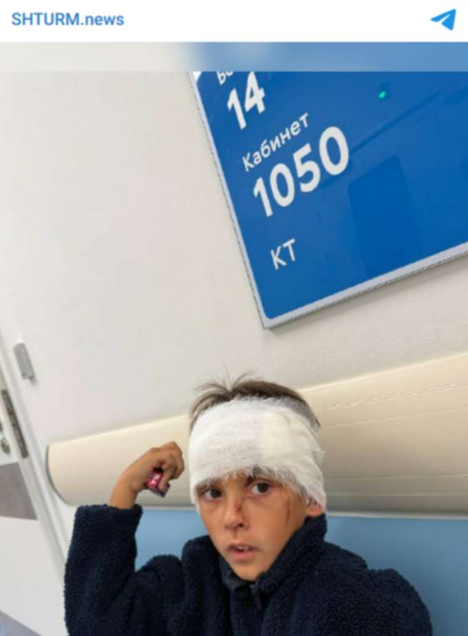 Внуку Натальи Штурм пробили голову булыжником: подробности и фото