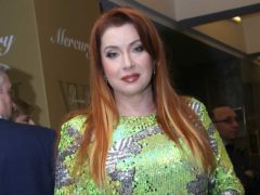 Подтянувшая лицо по бартеру Вера Сотникова изменилась до неузнаваемости: «Сделали дырку в подбородке и заклеили ее пластырем»