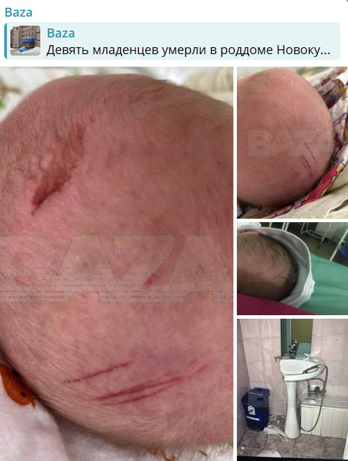 Оторванная рука, жуткие раны на головках: 9 младенцев умерли в роддоме Новокузнецка во время новогодних праздников
