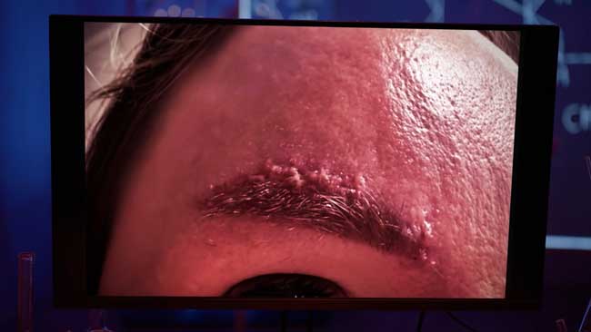 Брови мертвеца: история опасного бьюти-эксперимента