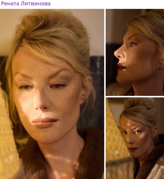 «Брови на макушке и ни одной морщинки»: Ренату Литвинову заподозрили в тотальной пластике