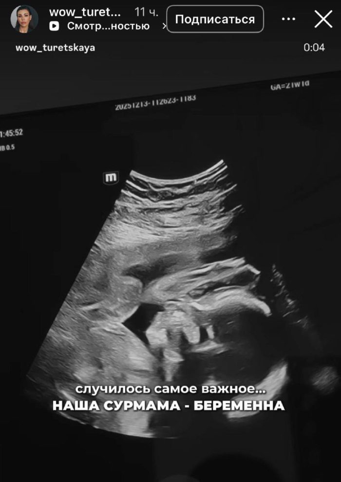 Пережившая аборт дочь Турецкого станет мамой в третий раз: подробности 