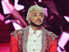 «Диабет, псориаз, неудачная пластика?» Жуткий ожог на руке Киркорова напугал поклонников