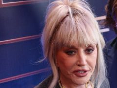 Решила соответствовать мужу? Косметолог рассказала о секретах омоложения Аллы Пугачевой