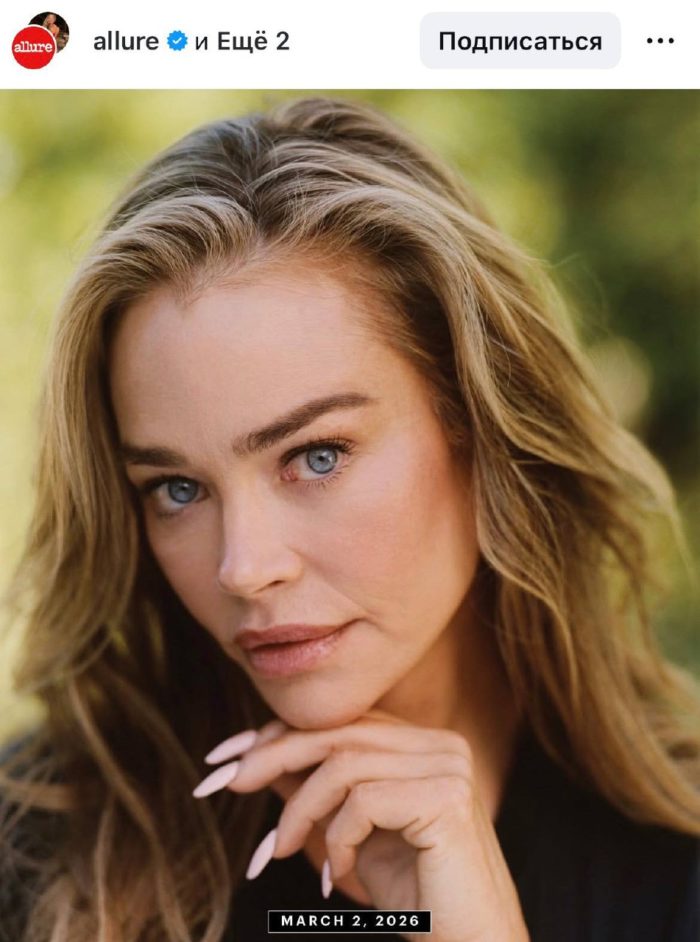 «Мои старшие дочери были недовольны»: что пластический хирург сделал с лицом звезды 90-х Дениз Ричардс (фото)