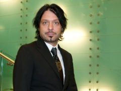 «Провалилось лицо»: что случилось с ведущим Владимиром Тишко