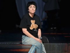 «Под нож больше не лягу»: какие пластические операции могла сделать Лолита